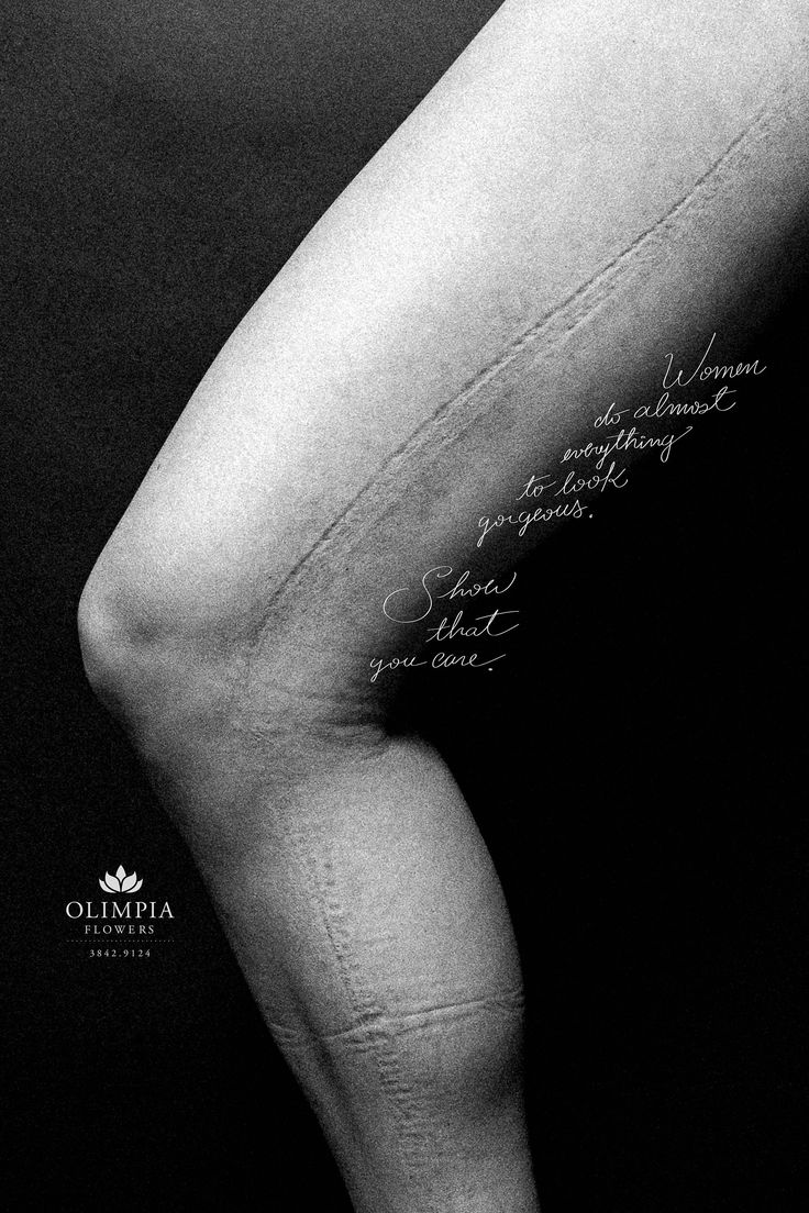 1538485119_74_Advertising-Campaign-Adeevee-Olimpia-Flores-Feet-Back-Leg Advertising Campaign : Adeevee - Olimpia Flores: Feet, Back, Leg