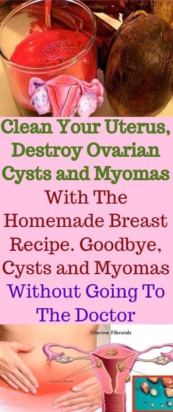 Healthcare-Advertising-Clean-Your-Uterus-Destroy-Ovarian-Cysts-and-Myomas-With-The-Homemade-Breast-Rec Healthcare Advertising : Clean Your Uterus, Destroy Ovarian Cysts and Myomas With The Homemade Breast Rec...