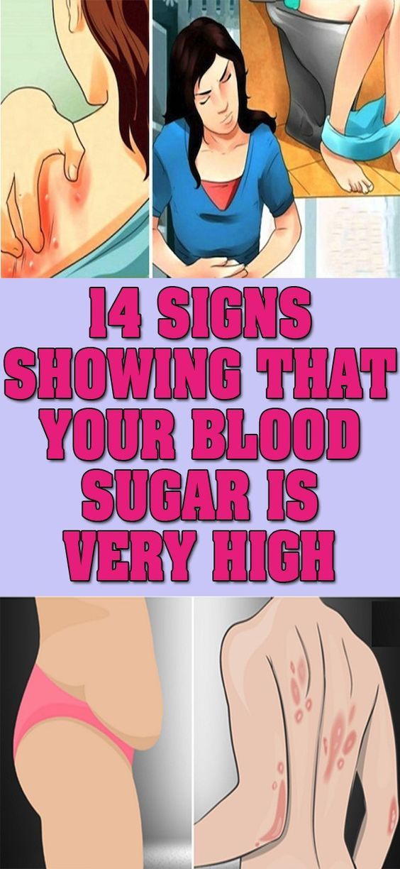  Advertising Infographics : 14 Signs Showing That Your Blood Sugar Is Very High
