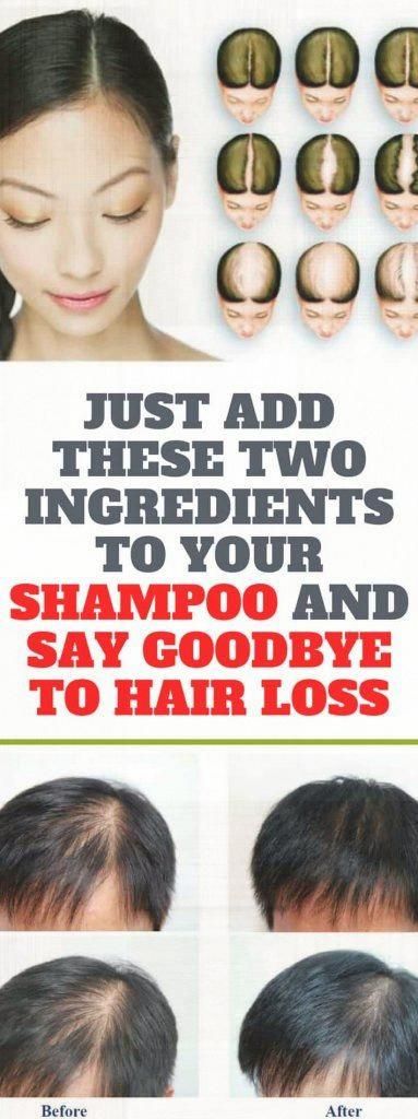 1564153120_860_Healthcare-Advertising-hair-loss-prevention-female-natural-home-remedy Healthcare Advertising : hair loss prevention female natural home remedy, All-natural treatments to stop ...