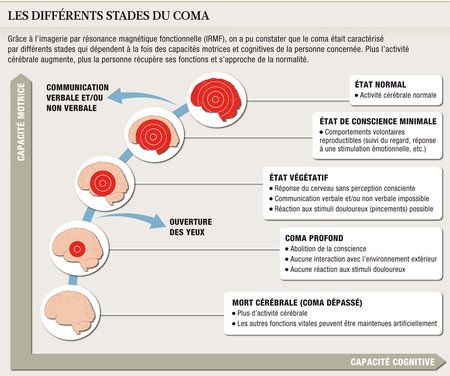 Psychology-Infographic-Les-differents-stades-du-coma Psychology Infographic : Les différents stades du coma