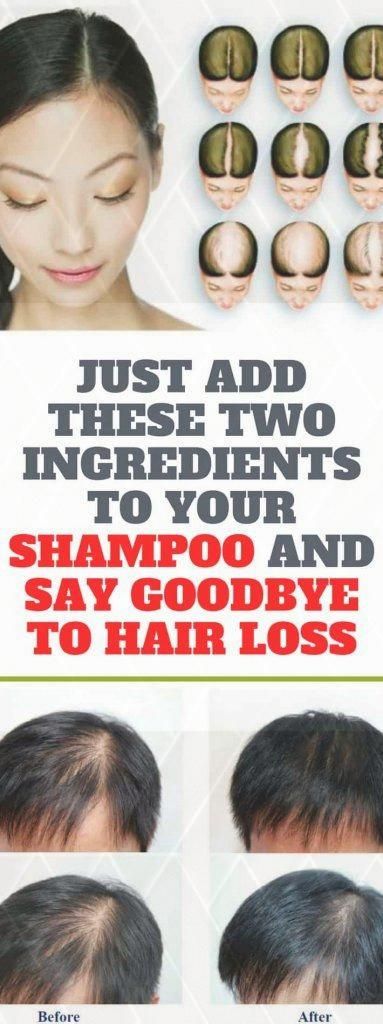 1566966538_449_Healthcare-Advertising-hair-loss-prevention-female-natural-home-remedy Healthcare Advertising : hair loss prevention female natural home remedy, All-natural treatments to stop ...