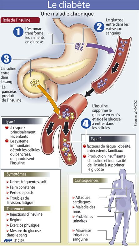 Infographic-Le-diabete-VOIR-VIDEO Infographic : Le diabète  -  VOIR  VIDEO