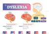 Infographic : Dyslexia medical disorder vector illustration infographic