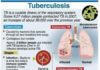 Infographic : Infographic on Tuberculosis – Test Kit